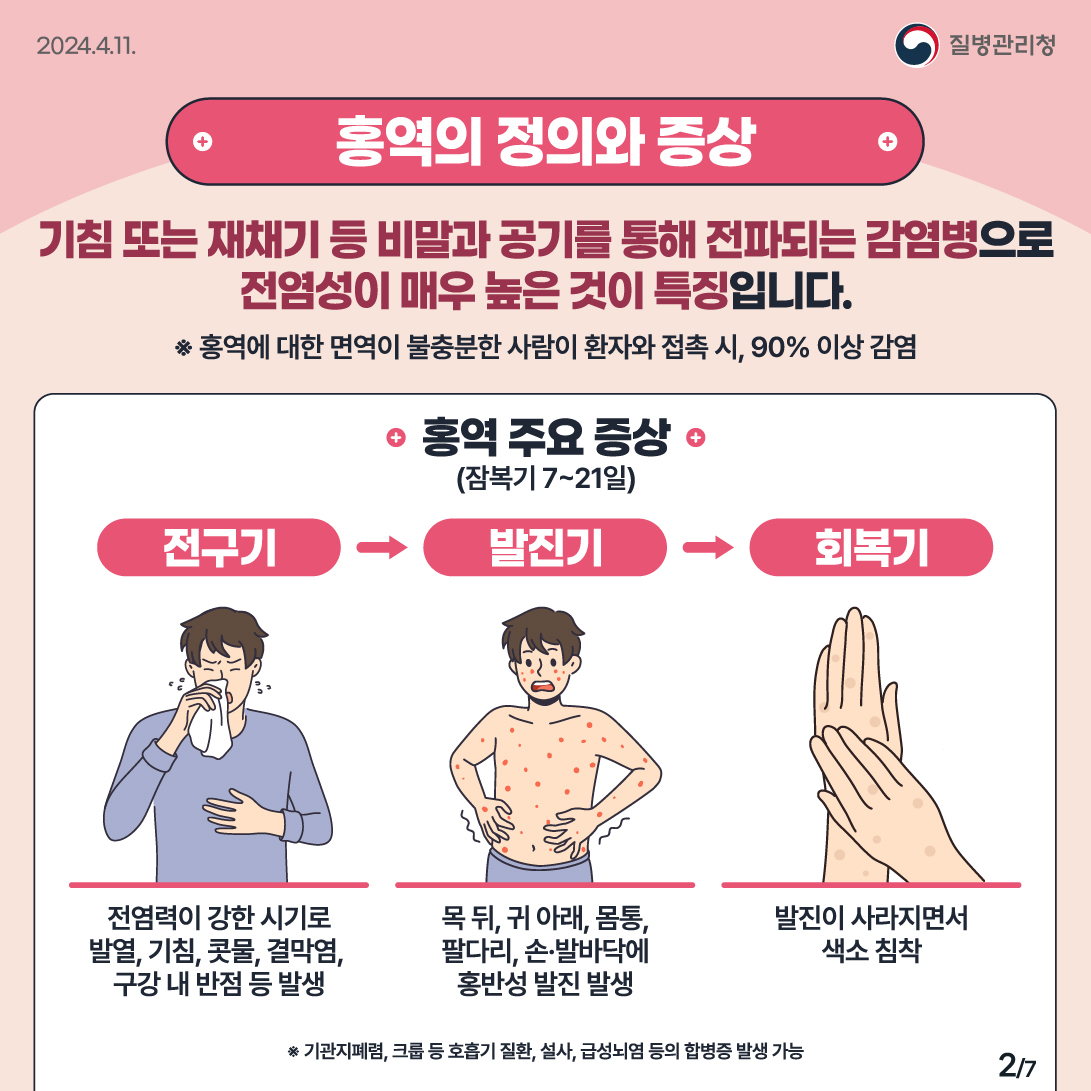 외국인 유학생 홍역 예방 수칙 안내